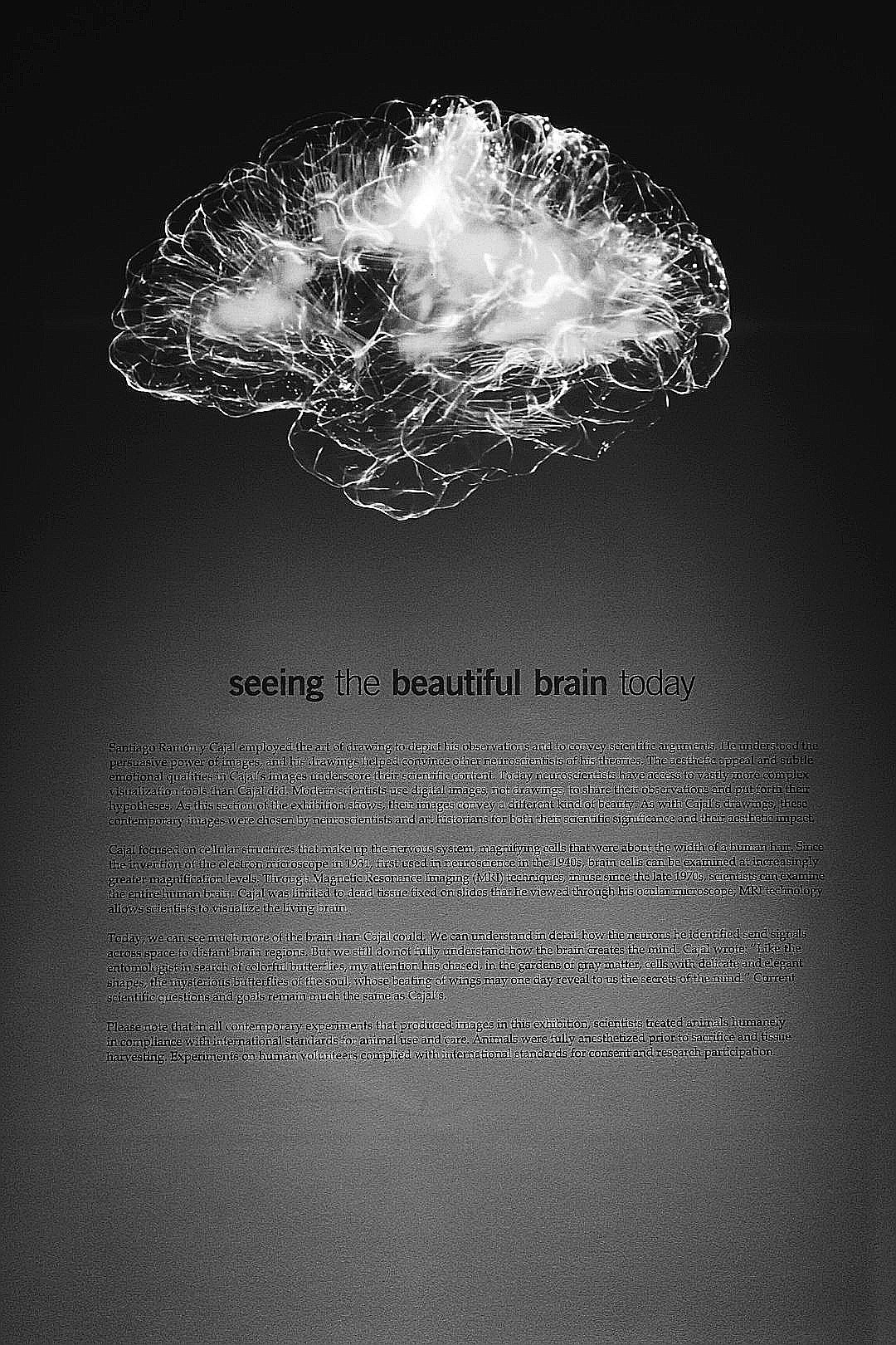 a black and white photo of a brain
